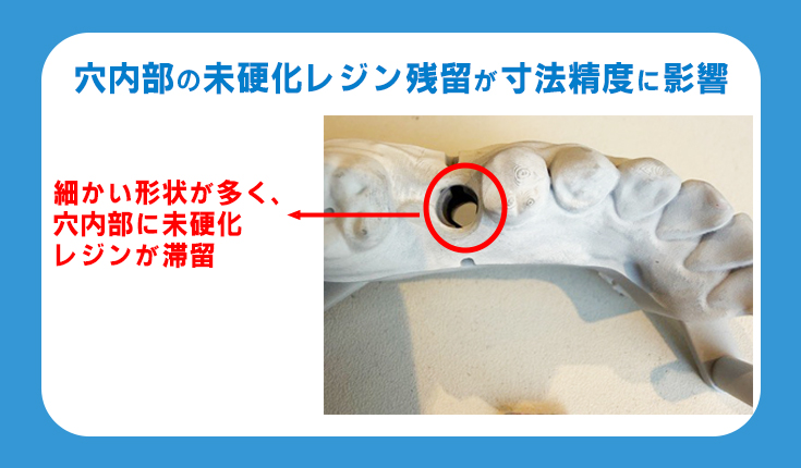 歯科技工所 3Dプリンタ 洗浄